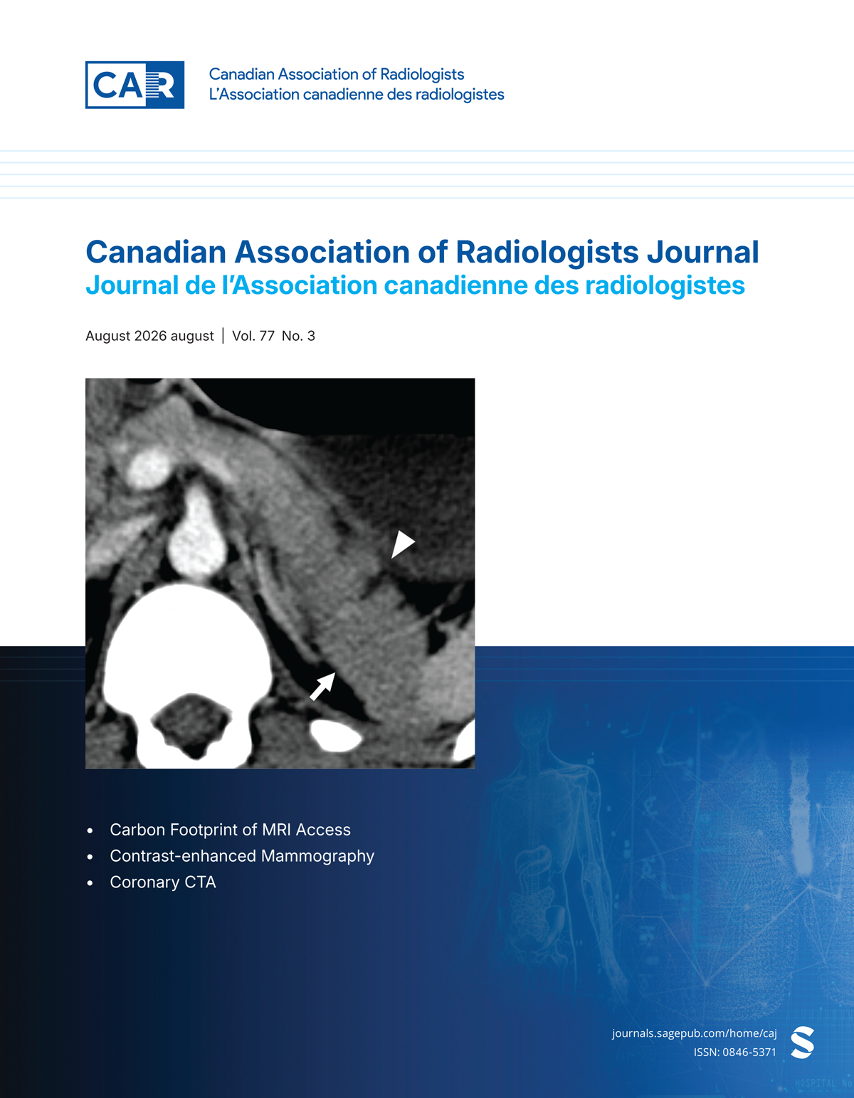 Canadian Association of Radiologists Journal journal cover