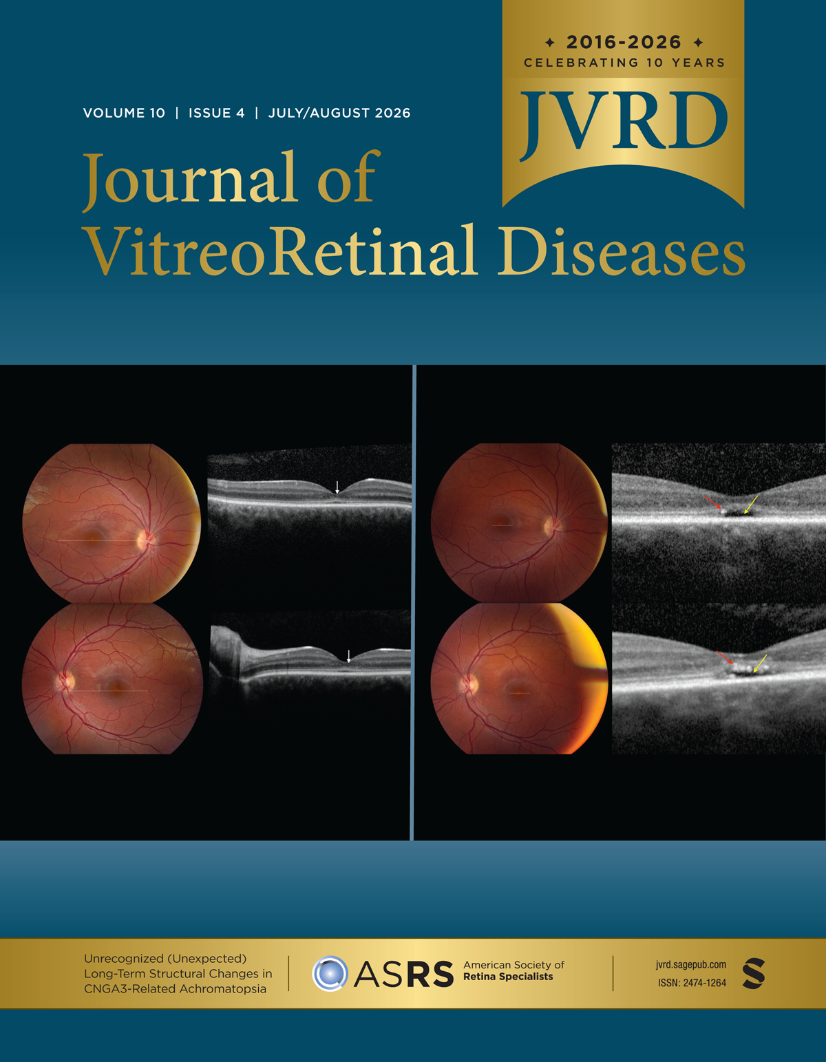 Journal of VitreoRetinal Diseases journal cover